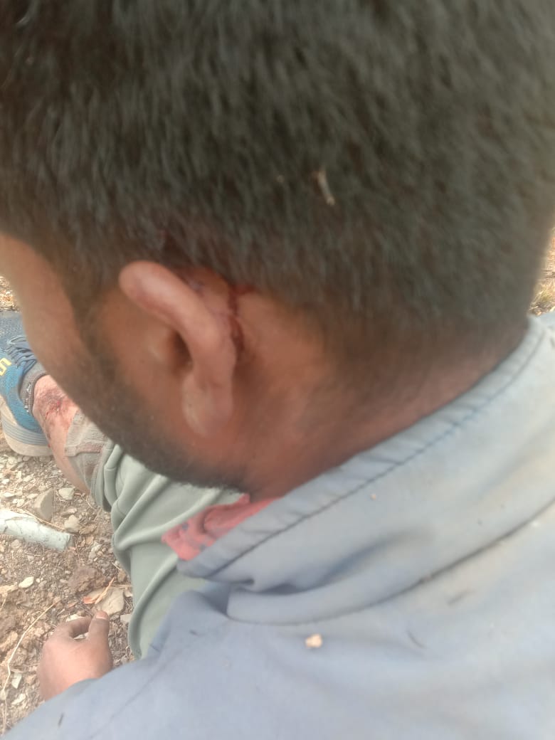 उत्तरकाशी में भालू का हमला जारी, एक व्यक्ति घायल