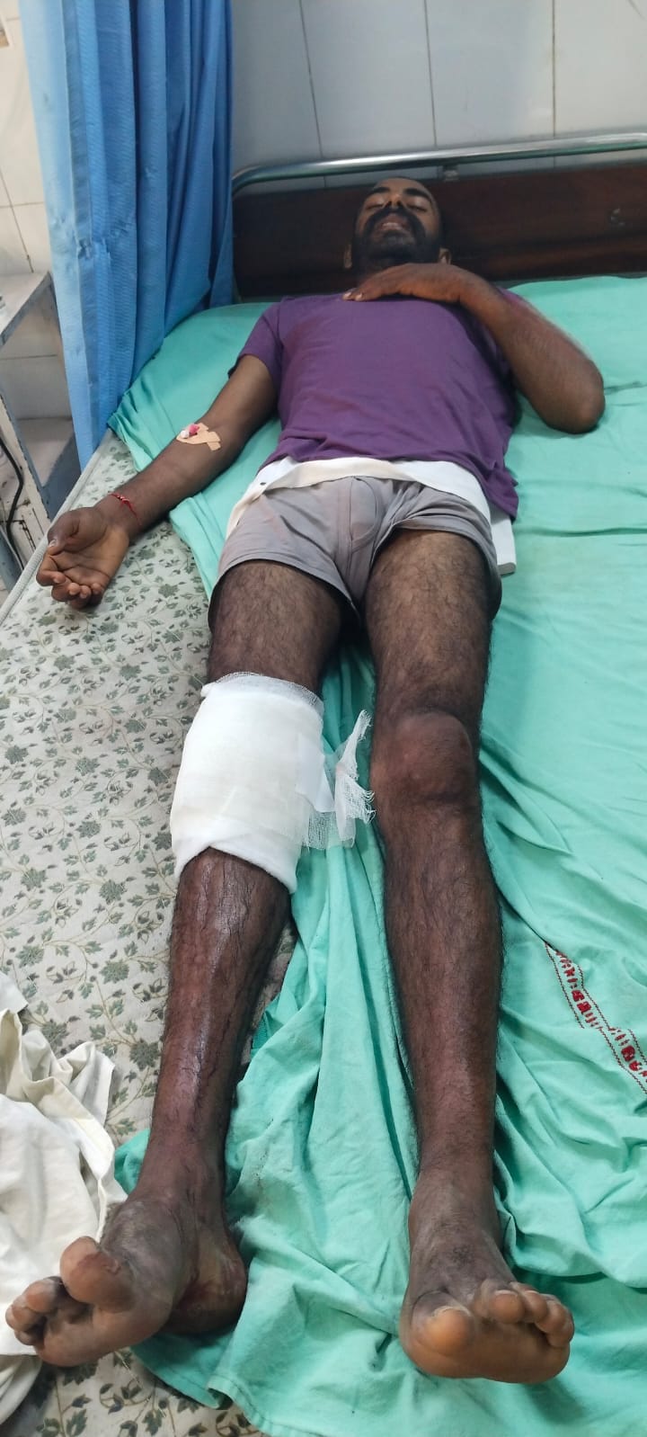 मर्डर व रेप का वांछित कुख्यात आरोपी मुठभेड़ के बाद काबू