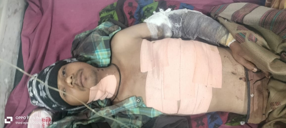 युवक पर चाकू से हमला, स्थिति गंभीर